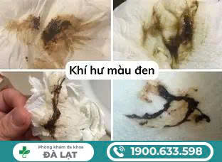 Hình ảnh minh họa